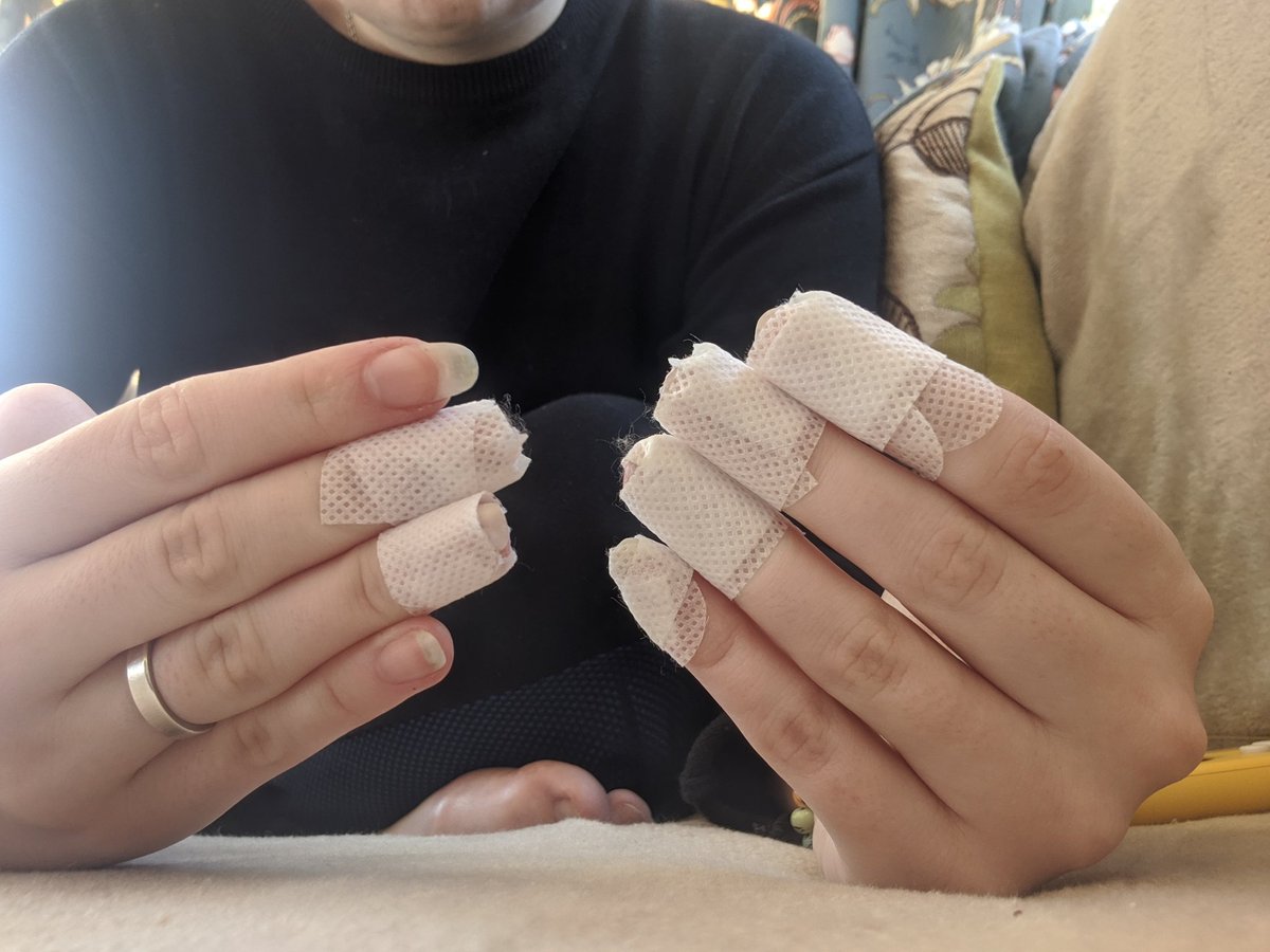 I'll spare you the gorey images, but this is my life. Excoriation (skin picking) is a symptom of OCD and BDD - two conditions I'm currently waiting on treatment for.11am - used 12 plasters.1:30pm - plasters were either peeling or soaked with blood. Redressed with bandages.o