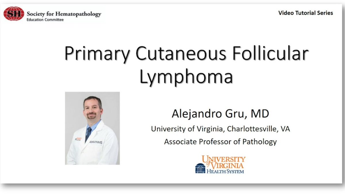 We are in the process of adding more material to our website--including this excellent live microscopy session by Dr. Alejandro Gru @UVA_Pathology on the DDx and histologic features of primary cutaneous follicle center #lymphoma! #dermpath #VirtualPath society-for-hematopathology.org/web/education-…