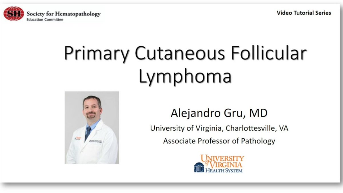 SocforHemepath (@socforhemepath) on Twitter photo We are in the process of adding more material to our website--including this excellent live microscopy session by Dr. Alejandro Gru <a href="/UVA_Pathology/">UVA Pathology</a> on the DDx and histologic features of primary cutaneous follicle center #lymphoma! #dermpath #VirtualPath society-for-hematopathology.org/web/education-… We are in the process of adding more material to our website--including this excellent live microscopy session by Dr. Alejandro Gru <a href="/UVA_Pathology/">UVA Pathology</a> on the DDx and histologic features of primary cutaneous follicle center #lymphoma! #dermpath #VirtualPath society-for-hematopathology.org/web/education-…