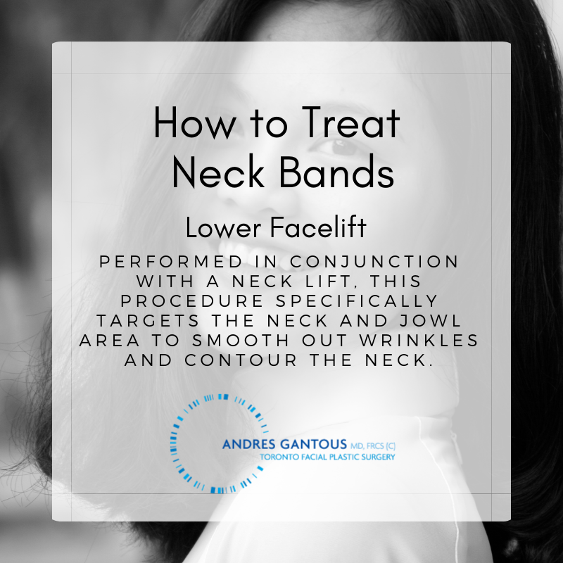 ToFacialSurgery's tweet photo. #NeckLift #Aging #CosmeticSurgery https://t.co/ABP89Mgnte