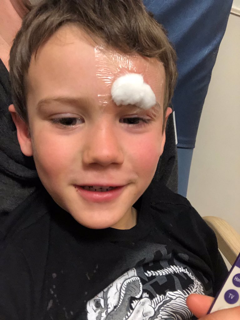 WeathersGov's tweet photo. Today became an interesting day #firststitches #madeitto4yearsold https://t.co/hmZAWnzVpR