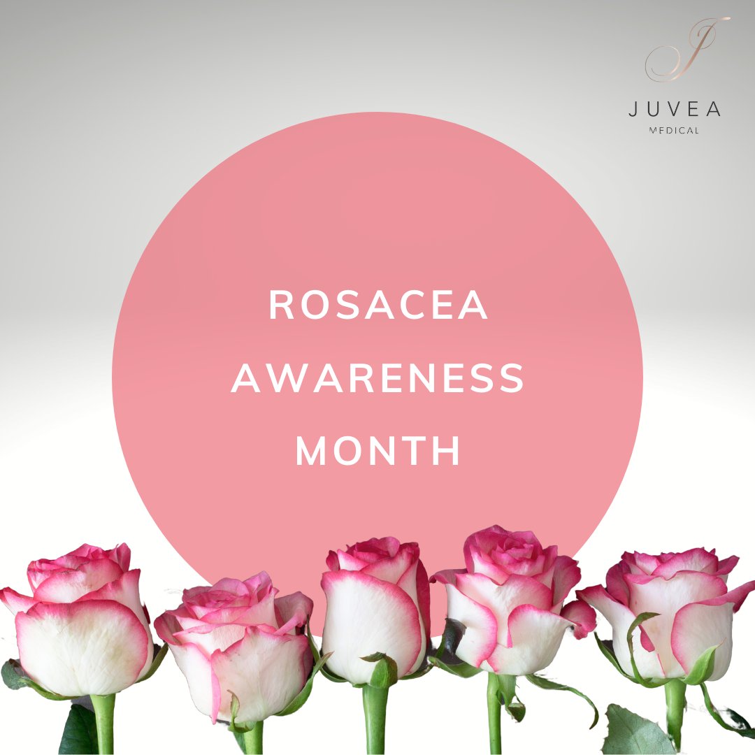 It's April - that means it's Rosacea Awareness Month! ❤️🌹
It's estimated that 1 in 10 people in the UK suffer from this chronic skin condition. Keep an eye out for our posts this month to give you advice and information about rosacea.