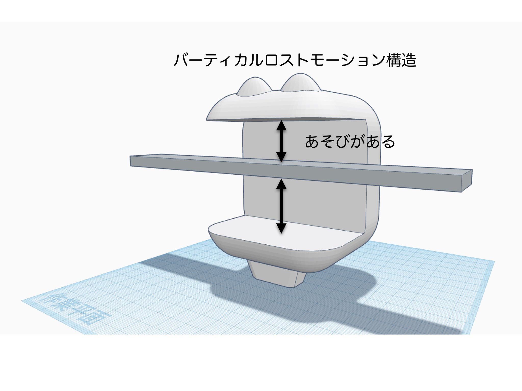 しらいし 矯正akiba フルパッシブ矯正の最新型ブラケットは T21 です ワイヤーとブラケットスロットの間に遊びがあります これがバーティカルロストモーションといって重要な要素です 極端に書くとこんな感じのイメージです スカスカなのでライト