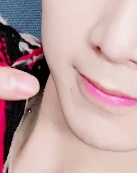 his chin mole (? which appeared once and disappeared forever