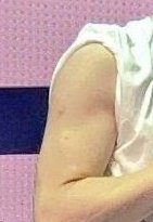 the birthmark on his arm