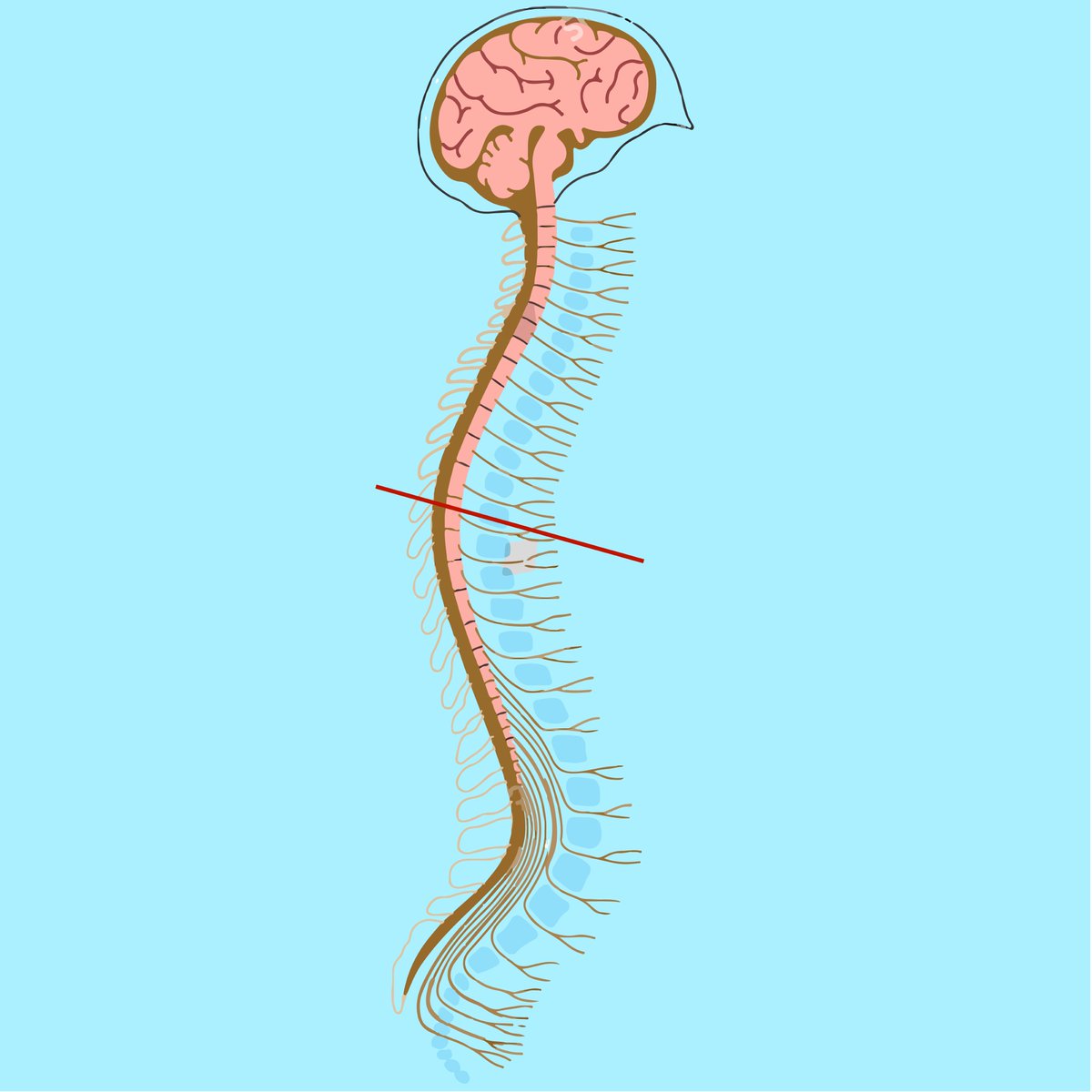 Our newest review is available here: bit.ly/Spadacini. This review is on the Science Advisory Board’s report on the brains responses to lesions and injury. Review by Spadacini and Fairfax. Score: 5/5. #science #news #Scifeye #research #reviews #brain #Neuroscience