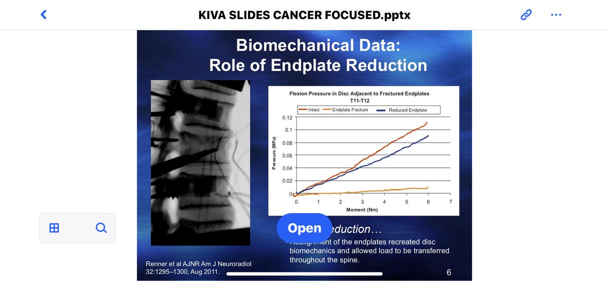 Best example of height restoration and re-pressurization of the disc I’ve seen in a while.