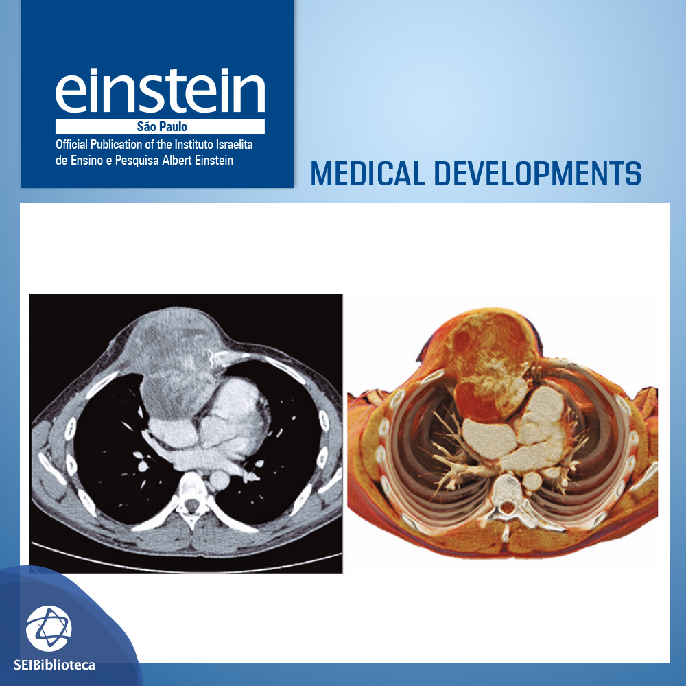 journaleinstein's tweet photo. #MedicalDevelopments | Cinematic rendering for three-dimensional reconstructions of the chest wall: a new reality. 

Find out more at https://t.co/nrSuxmawjC 

#publishedineinstein #journaleinstein #ComputedTomography https://t.co/PIwM1gRzdD