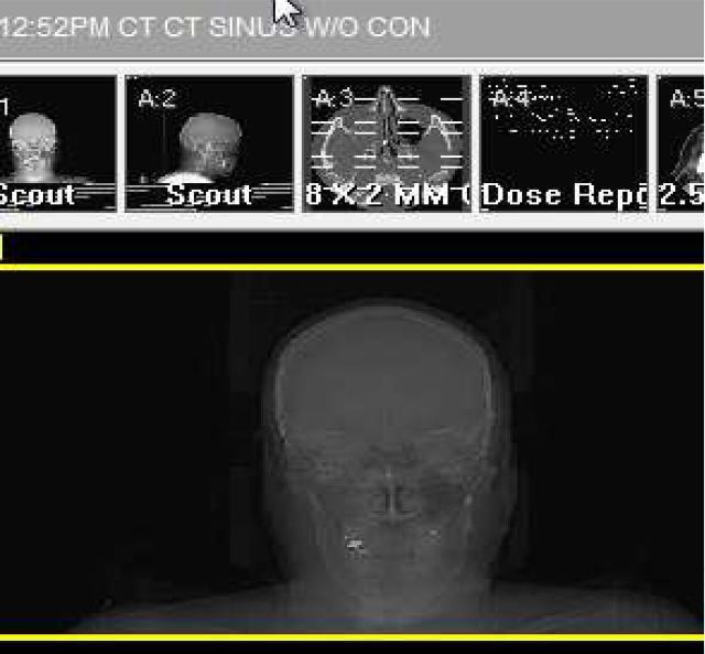 ImageGently's tweet photo. Are Risks From Medical Imaging Still too Small to Be Observed or Nonexistent?
https://t.co/aos0OlBGyi https://t.co/SmZNlCHzjr