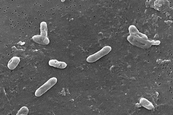 remevet's tweet photo. Bordetella bronchiseptica (Bb) es una bacteria gramnegativa que coloniza las vías respiratorias de los mamíferos. Es uno de los agentes patógenos más importantes de los gatos domésticos, sobre todo en condiciones de gran densidad de población.
Vía: Clínica veterinaria Neko. https://t.co/EpMa37d6hm