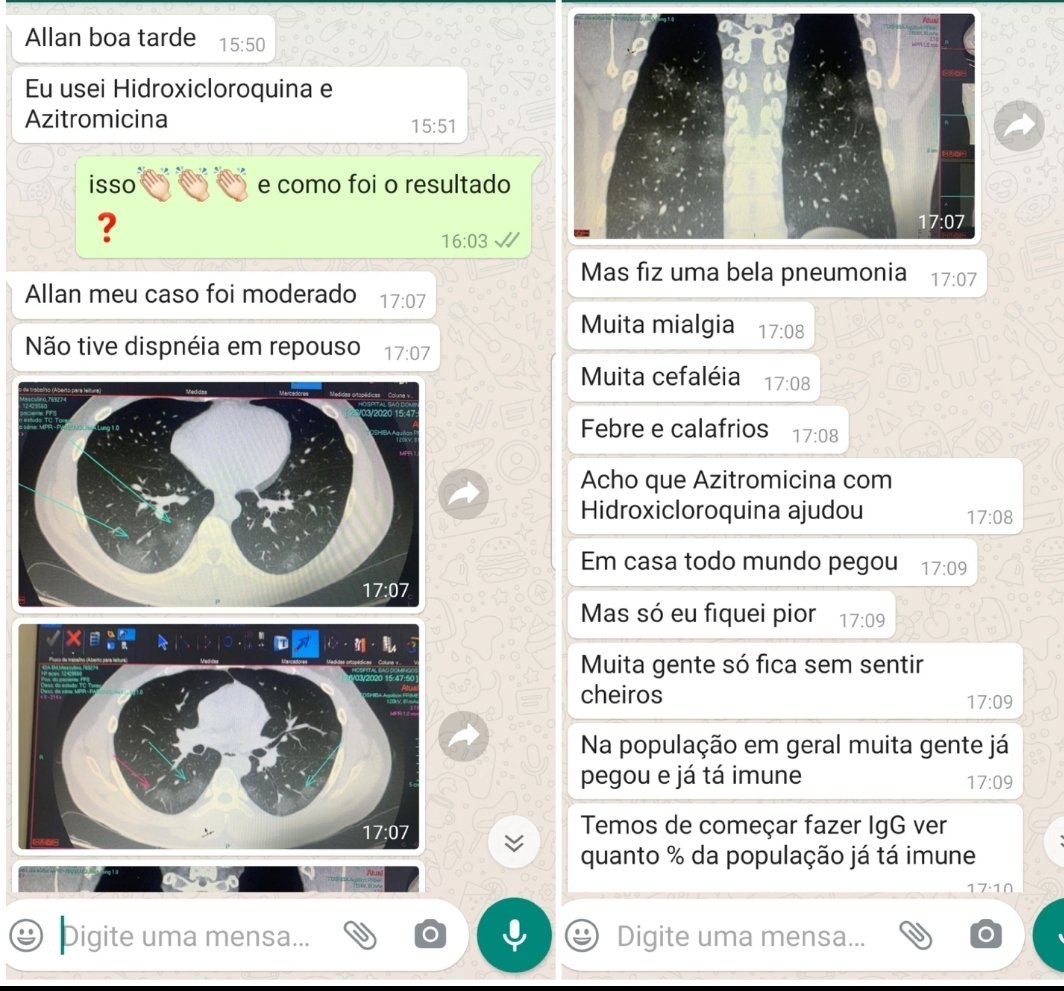 drallangarces's tweet photo. Outro colega médico que adoeceu, cuidando de pacientes com o CoVID-19 e que ainda acabou contaminando toda sua família. Graças a Deus, ele ficou curado fazendo uso da Hidroxicloroquina e Azitromicina.
O BRASIL ESTÁ VENCENDO! https://t.co/zjODpY5xOG