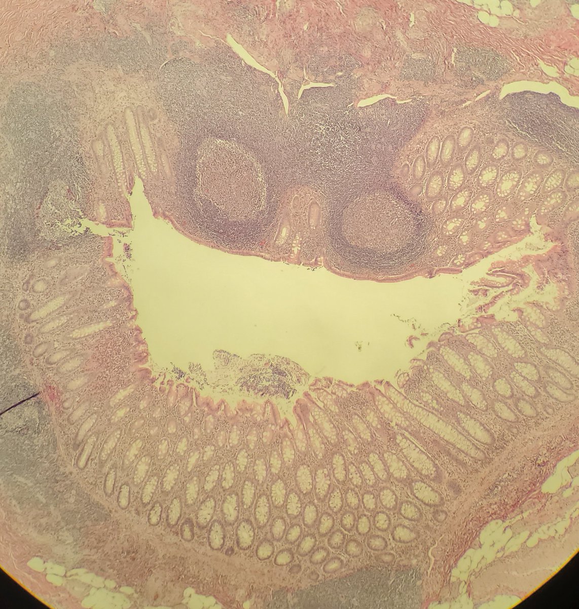 collinpryma's tweet photo. Not sure what this appendix is so happy about https://t.co/J5U5lktHCI