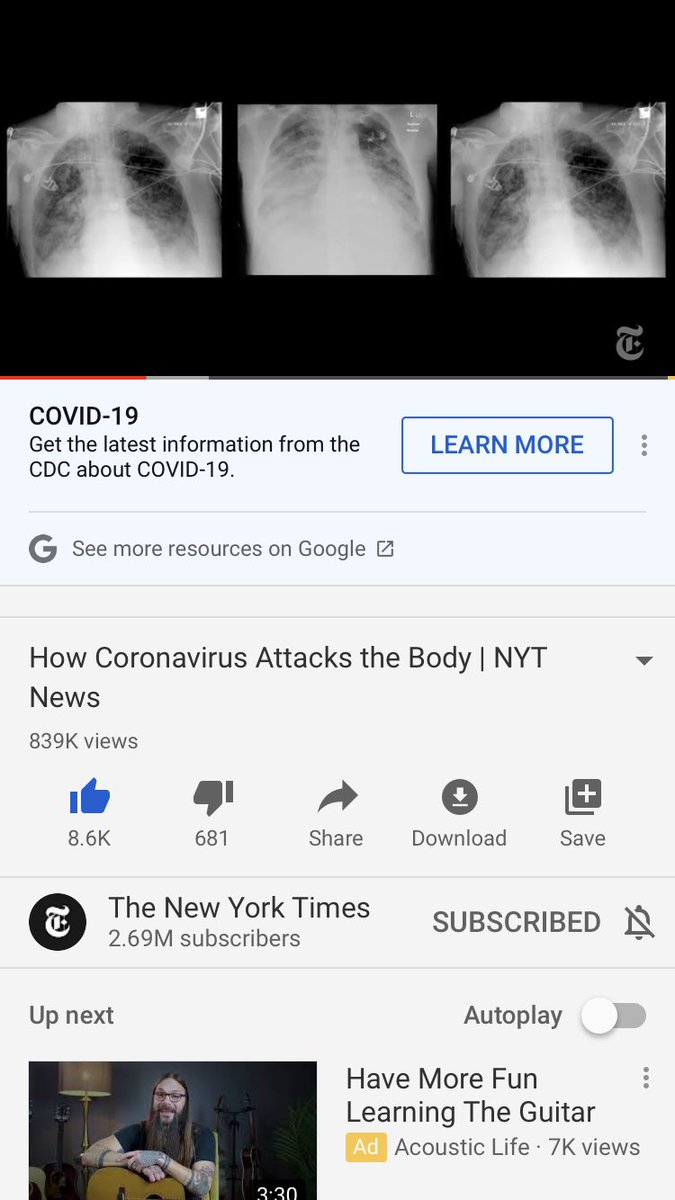 25. If you prefer to watch this COVID-19 video on YouTube, the link is here. Amazing visuals and graphics! Nearly a million people have watched in the first 2 days. Here’s the link  #pathology  #pulmpath  #COVID19  @pembeoltulu  @GeronimoJrLapac