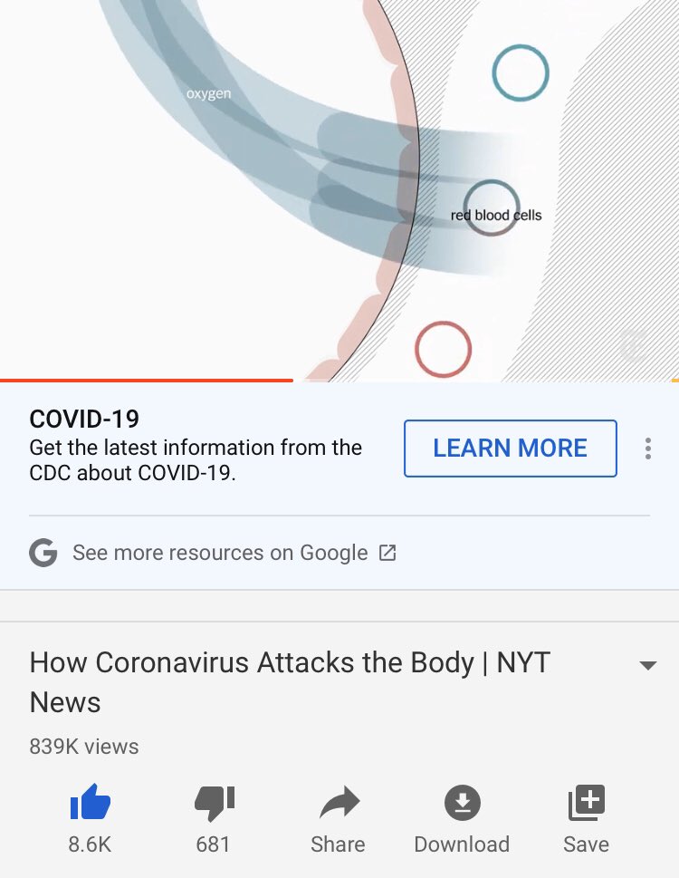 25. If you prefer to watch this COVID-19 video on YouTube, the link is here. Amazing visuals and graphics! Nearly a million people have watched in the first 2 days. Here’s the link  #pathology  #pulmpath  #COVID19  @pembeoltulu  @GeronimoJrLapac