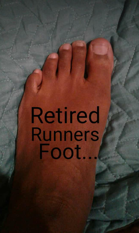 ThatShangaanGal's tweet photo. @MashadiChristyM na @phorapoo lol this is the only challenge im brave enough to take part in.πππ
Since in a retired runner.
#retiredrunner
#socialrunner
#ToesChallenge https://t.co/rveVAaq6ed