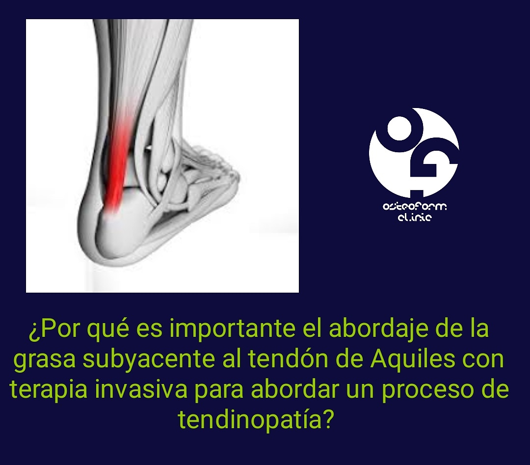 OsteoForm Clinic tweet media