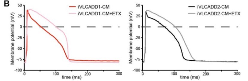 Quite remarkably, ETX indeed prolonged action potential, reduced DADs and calcium transients. Maybe not to the same extent as RSV, but importantly, the concept worked in cells of both patients!