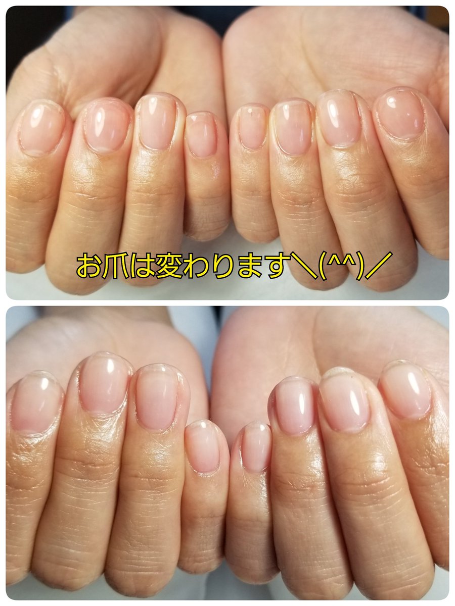 自爪育成 深爪緩和専門ネイルサロン このみ 0712 Yama Twitter
