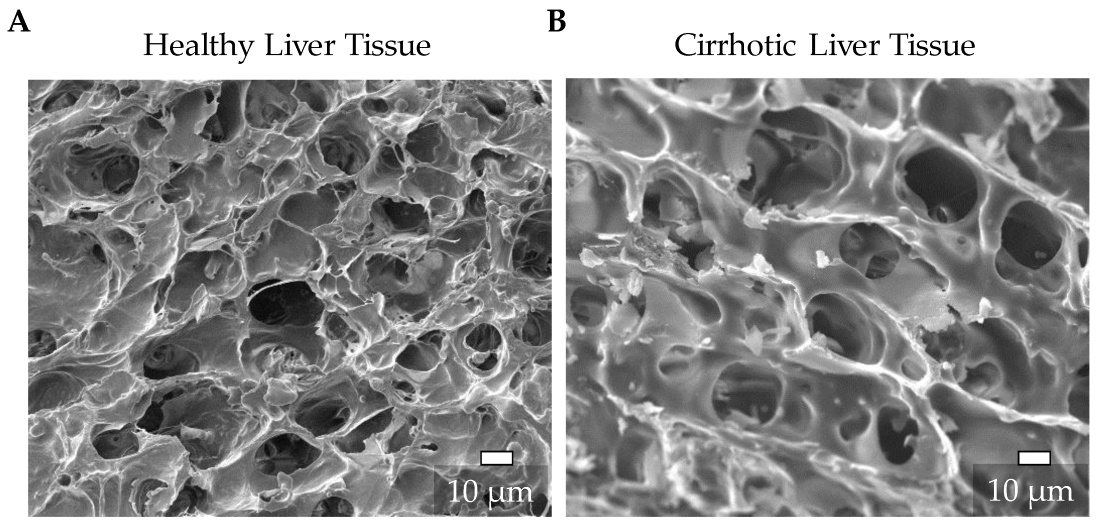 Prof. Dr. Andreas Nüssler and his team from Eberhard Karls University <a href="/uni_tue/">Universität Tübingen</a> developed scaffolds that mimic the stiffness of a healthy and diseased #liver tissue. Read more about how liver cells seeded onto these scaffolds reacted here: bit.ly/34mxJum