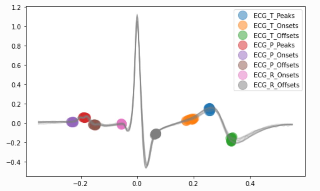 Dom_Makowski's tweet photo. #NeuroKit2 is now the first #Python package implementing not one, but several methods for #ECG QRS delineation 💓 allowing you to identify cardiac phases and other components with great precision! 👇
https://t.co/3HijOqB8FG
Made possible by the brilliant work of @tampham94 🙌 https://t.co/RQiANqW8Yi