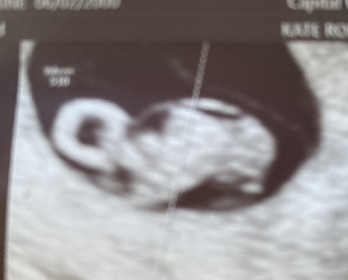 Meet my little Tortue! Yes, I am going to be a grandma!