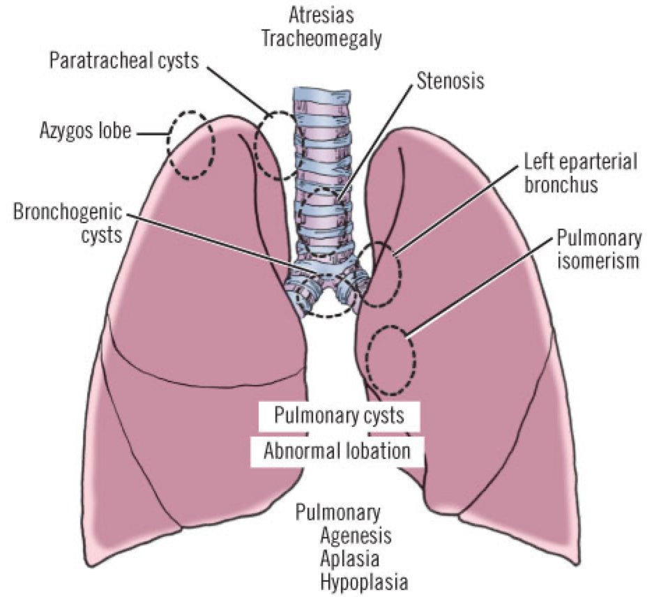 Congenital anomalies of the trachea and lungs.

#MedEd for doctors over #Twitter 

From: Skandalakis, 2004.