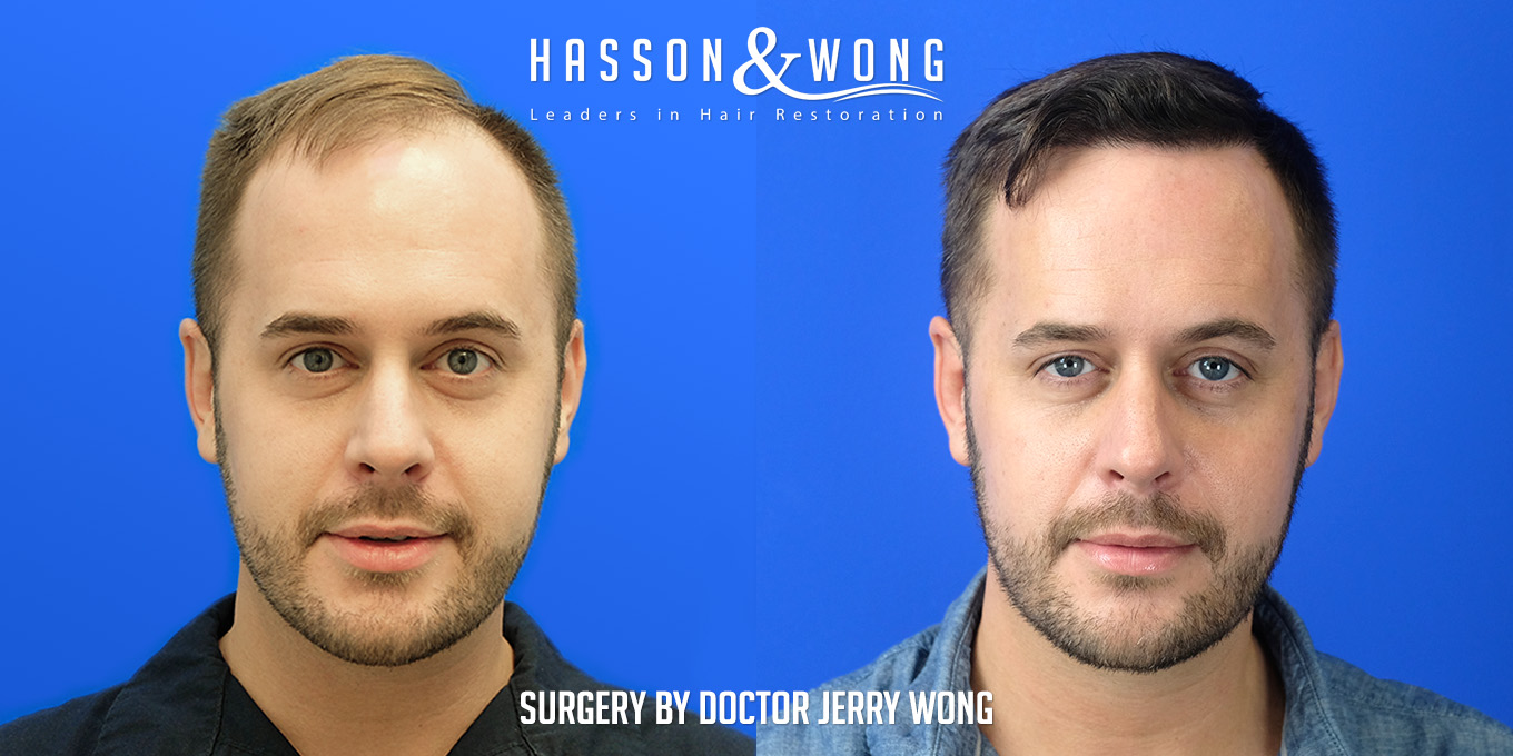 Hasson and Wong on Twitter: Hasson and Wong on Twitter: