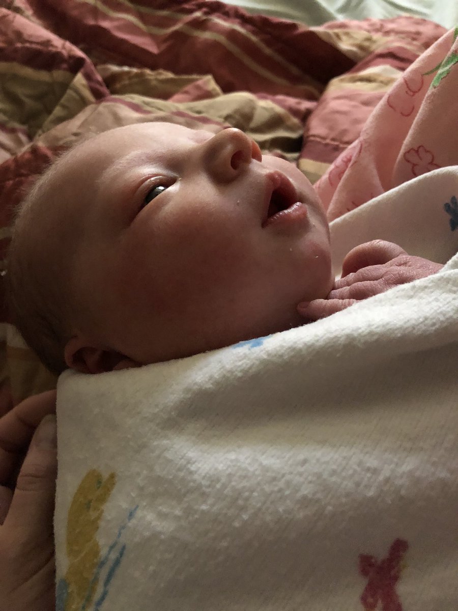 Jay_Tust's tweet image. SHEโS HERE!!! SHEโS HERE!!!
Weโd like you all to meet our daughterโฆ
๐ถ๐ผ Collins Claire Tust
๐ April 7, 2020
โฐ 8:40 p.m.
โ๏ธ 8 lbs 4 oz
๐ 21โ
Collins took the whole โstay at home orderโ seriously. She arrived 3 days late, but she is healthy and doing great, and so is mom.
๐