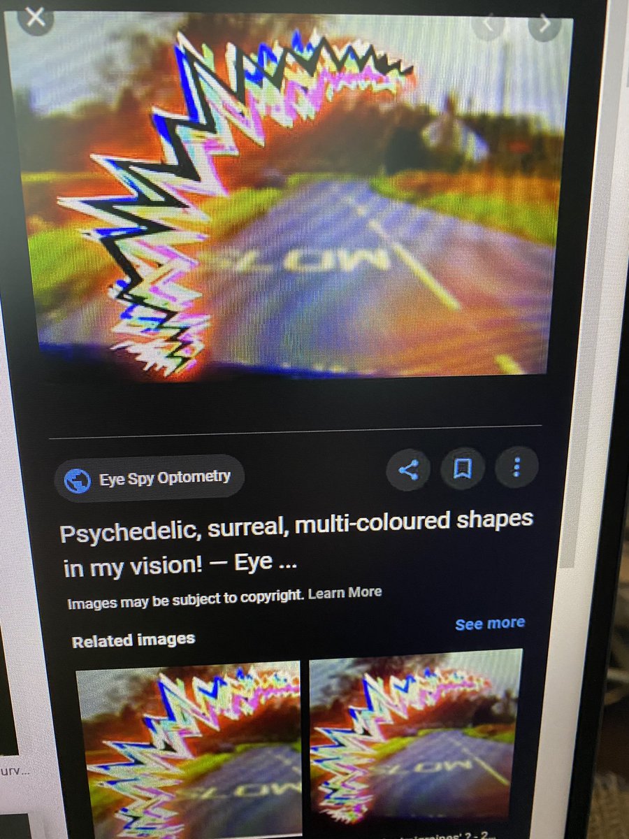 ChrisPhillips37's tweet photo. Having eye migraines again. Its the chip doing this. Went to the eye doctor last week and my eyes are perfectly fine with 20/20 vision.. https://t.co/eMQWm2Wpkb