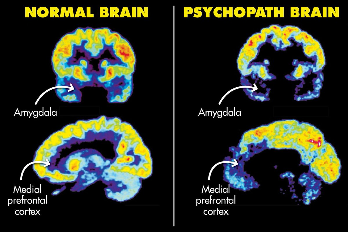 7) Brain anatomy, genetics and environment are all contributing factors towards the development of psychopathic traits.