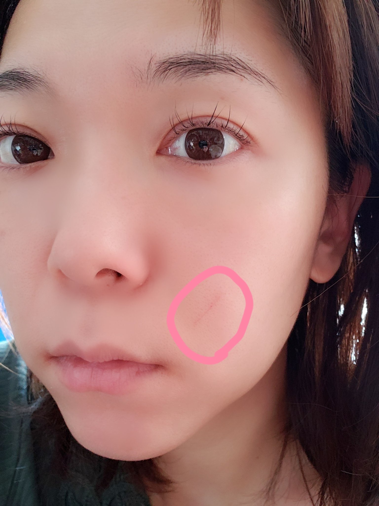 花咲ゆき美 こんにちは 朝顔を洗ったら ほっぺが痛いから ん と思ったら 顔に傷が 寝てる時に自分で引っ掻いたらしい おっちょこちょいだね私 T Co Buudg66fdb Twitter