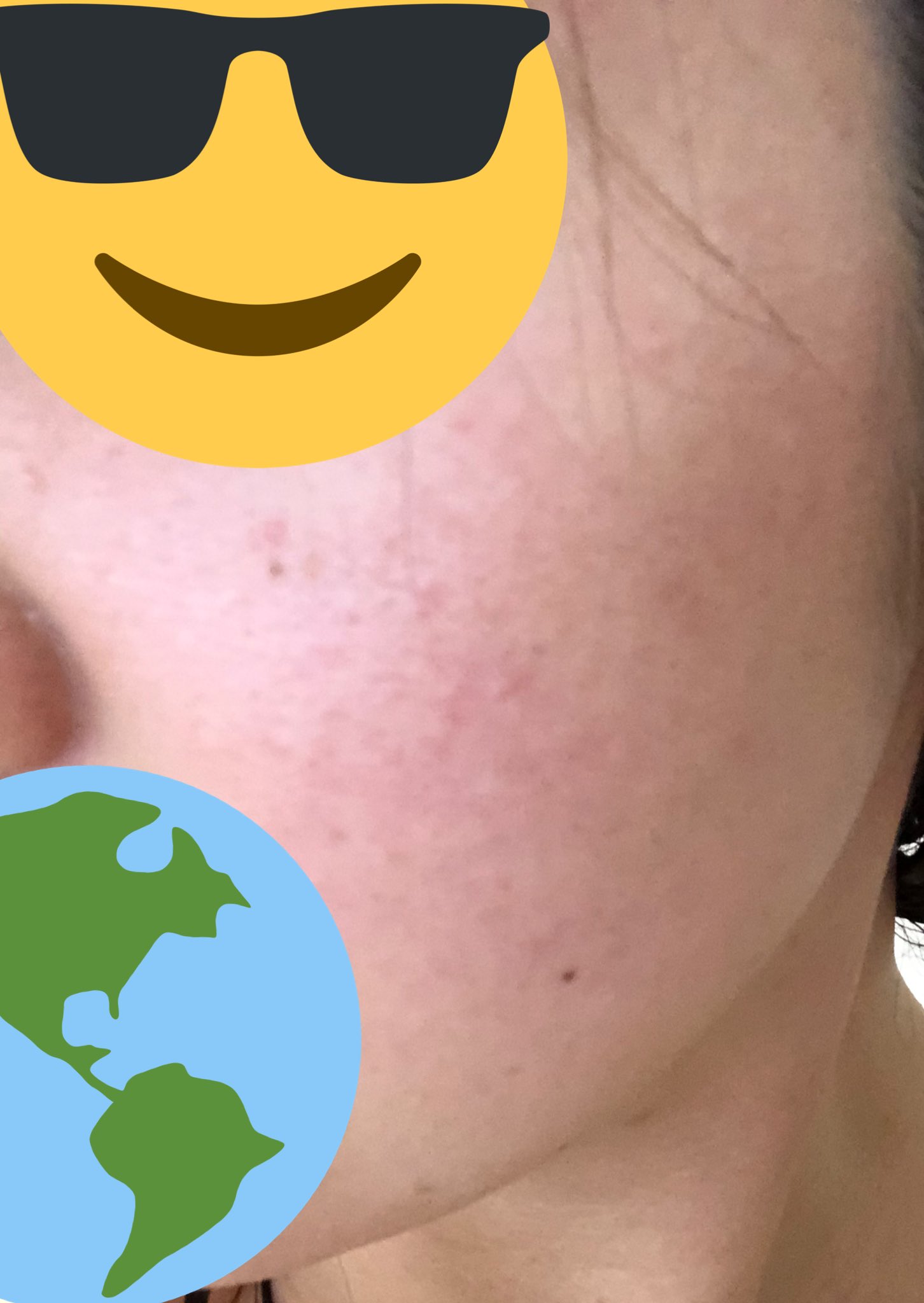 彼女ちゃん まだまだ全然だけどかなり良くなった エンビロンとクリスタルエッセンスでだいぶ乾燥しらず あとは毛穴の開きと小さい ブツブツが居なくなってくれれば T Co W8l5ecijlv Twitter