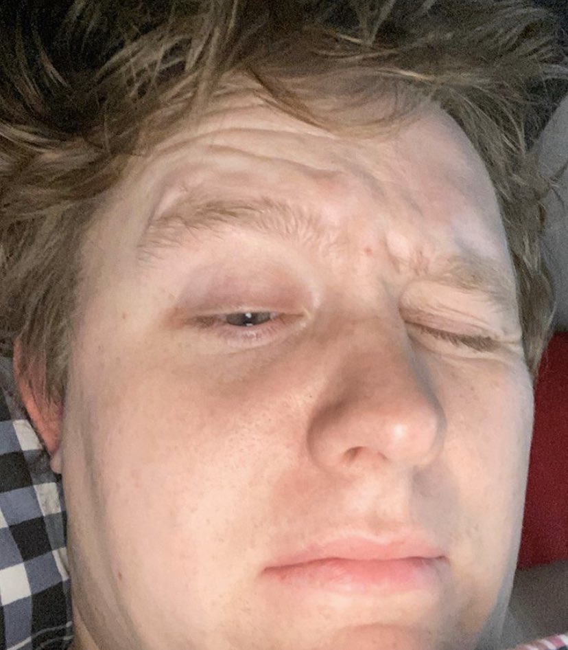 Lewis Capaldi as emojis: a thread