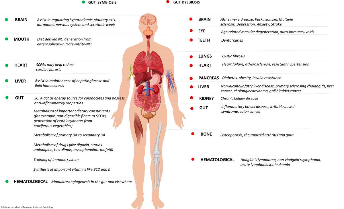 ESC_Journals's tweet photo. What is your Gut feeling about #HeartFailure? Read about the impact of Gut microbioom and #heartfailure in #EJHF by @JavedButler1 https://t.co/8Uz3E2tgZK

@MarcoMetra @HFA_President @kevin_damman #cardiotwitter https://t.co/uyyHSroxlc