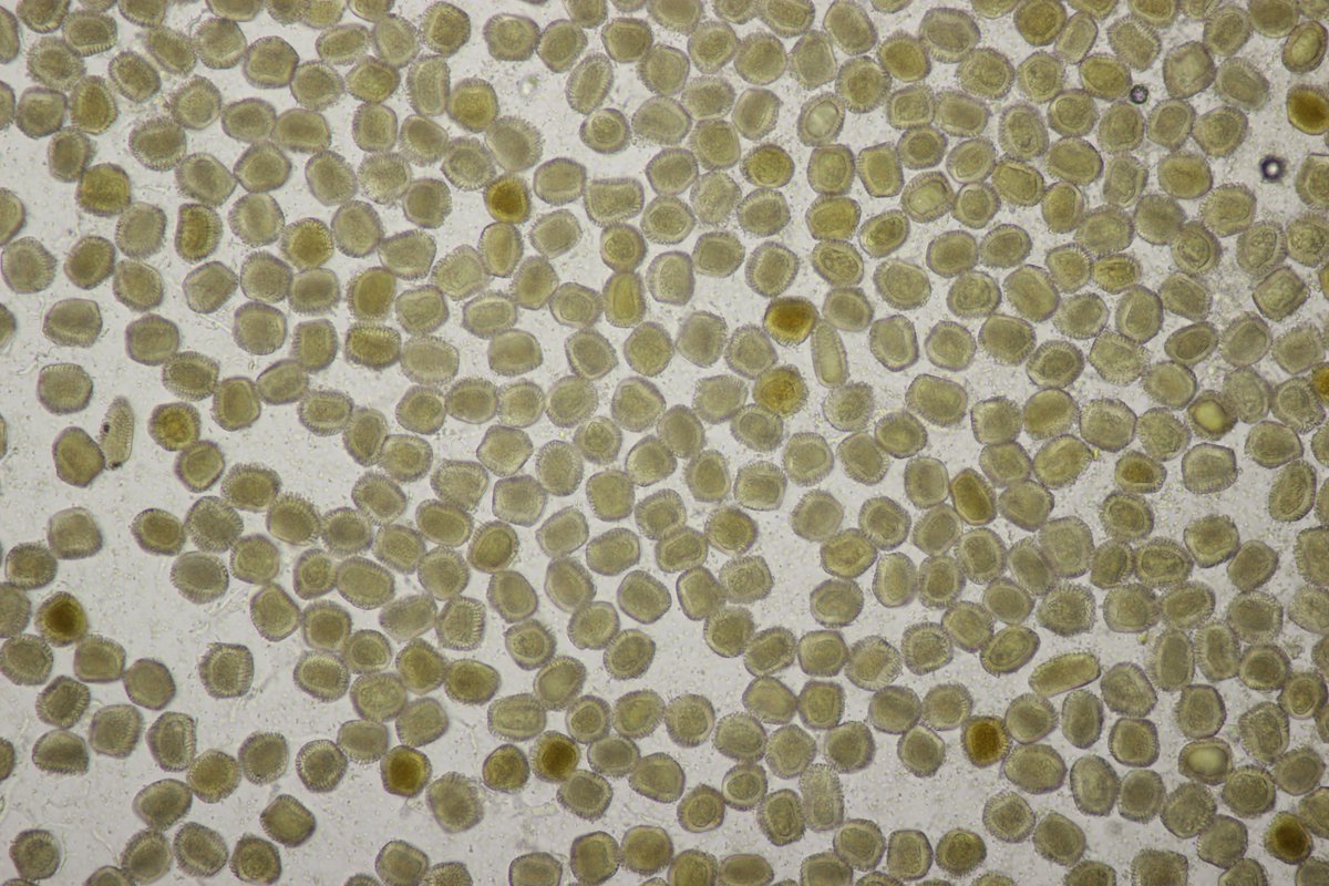 RPilze's tweet image. Thekopsora areolata ex Picea abies

#Thekopsoraareolata #Thekopsora #Pucciniastrumareolatum #Pucciniastrum #Fichtenzapfenrost #rost #rostpilz #rust #rustfungus #Fichte #Picea #Piceaabies #mushroom #mushrooms #fungus #fungi #pilz #pilze #champignons #champignon #nature #natur