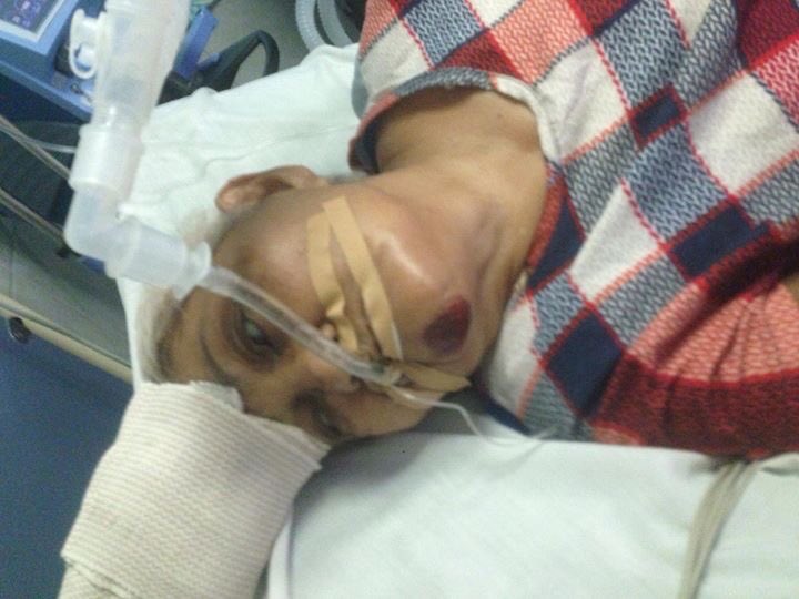 keenethvargas's tweet photo. 🚧 PLEASE RETWEET !!! 🚧
ASKING FOR YOUR HELP PARA MAPANSIN ITONG PANAWAGAN KO SA MGA MABUBUTI ANG PUSO NA MAKAKATULONG SAMIN UPANG MAILABAS NA SIYA SA OSPITAL.
SIYA SI ASUNCION VARGAS ASANZA 79 GULANG SIYA PO'Y NASAGASAAN (MAY TAMA SA ULO AT 6 ANG BALI) https://t.co/TzU338fZFL
