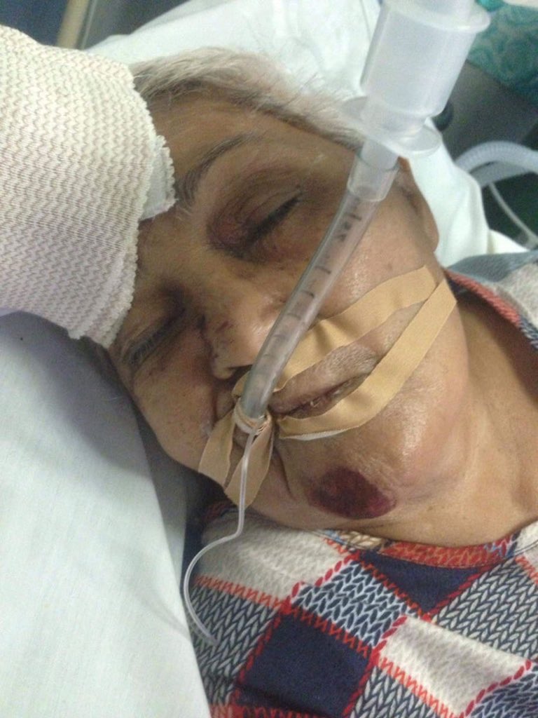 keenethvargas's tweet photo. 🚧 PLEASE RETWEET !!! 🚧
ASKING FOR YOUR HELP PARA MAPANSIN ITONG PANAWAGAN KO SA MGA MABUBUTI ANG PUSO NA MAKAKATULONG SAMIN UPANG MAILABAS NA SIYA SA OSPITAL.
SIYA SI ASUNCION VARGAS ASANZA 79 GULANG SIYA PO'Y NASAGASAAN (MAY TAMA SA ULO AT 6 ANG BALI) https://t.co/TzU338fZFL