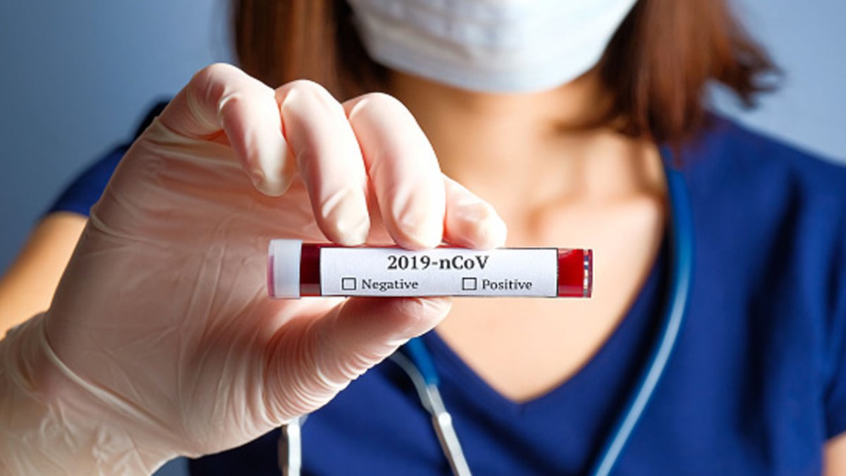trendingistng's tweet photo. Mass Coronavirus Test Not Feasible Now -FG
https://t.co/uOKZObbhWI https://t.co/MBo4oMSNG5