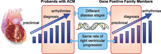 Cardiomyopathie arythmogène du VD - article interessant dans <a href="/ESC_Journals/">European Society of Cardiology Journals</a> 

academic.oup.com/eurheartj/arti…

<a href="/SFCardio/">SFC - Société Française de Cardiologie</a> <a href="/CCF_cardio/">CCF</a> <a href="/PresidentCNCH/">Président CNCH</a> <a href="/CNCHcollege/">Collège National des Cardiologues des Hôpitaux</a>