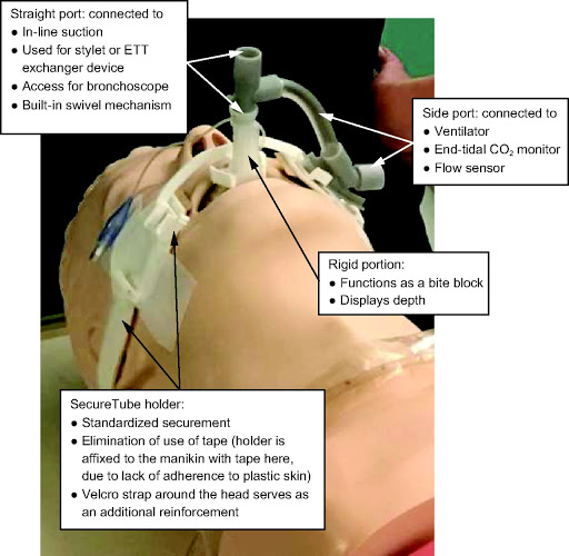 Without the balloon, any build-up pressure will be sent into the room, as I said, you'll be ventilating the hospital. Among the sensors placed with the balloon is humidity so the doctors/nurses can know of there is fluid buildup and intervene.