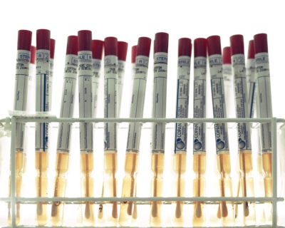 Pirbright are proud to be supporting the UK’s effort to ramp up diagnostic testing for COVID-19 by providing equipment and volunteers ow.ly/9mh850z9RCw #COVID19