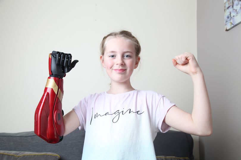 TeamUnLimbited's tweet photo. 😎 Some good news for these dark times! @openbionics have funding available for below-elbow limb-different kids aged 8-18 to get one of their multi-grip bionic Hero Arms! 🦾 

If that sounds like you or someone you know, sign up here: https://t.co/uB7iSNuUUD https://t.co/OwpgT96w9H