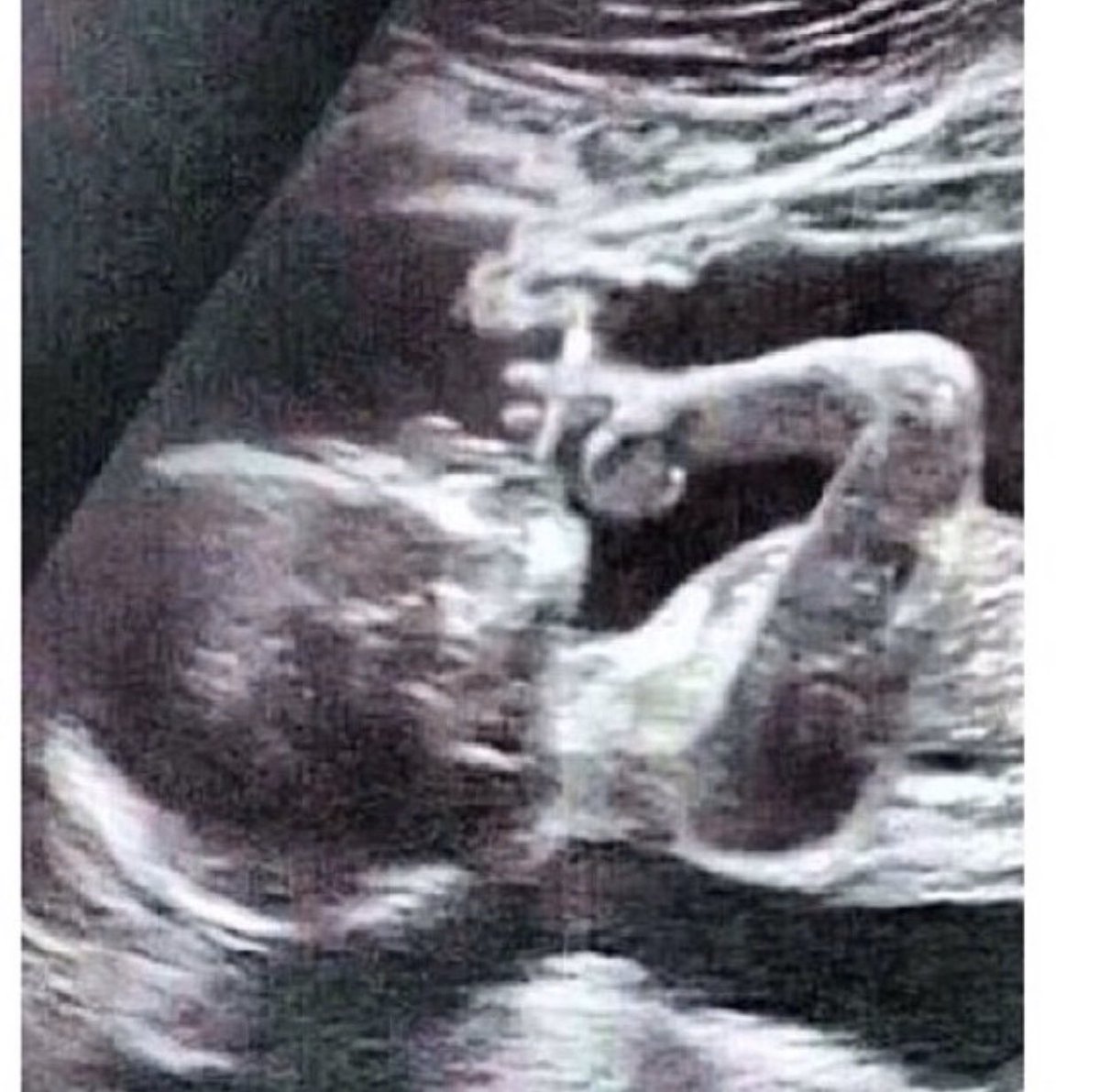 My baby scan picture before I was born