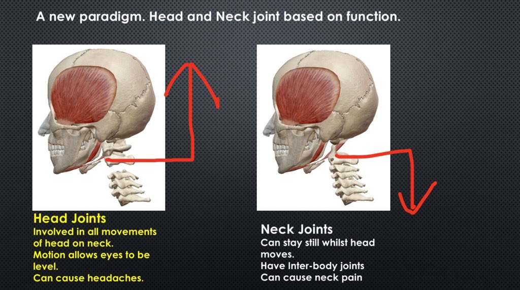 Cervical headaches, cervicaogenic vertigo, WAD, and a host of other useful stuff (stuff that takes a while to discuss)I will post a few pictures and other useful things. Thanks for reading. Another ramble done.