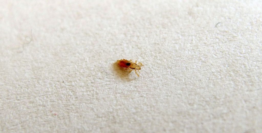 MyBeardGang1's tweet photo. How Long Can You Have Lice Before Noticing https://t.co/o2xwHfU1f1 https://t.co/a7xjSnp9vF