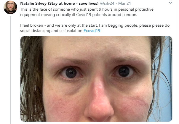 8: Look at these photos of NHS workers after their long shifts, saving lives. Their masks are cutting in to their faces.Stop thinking that your 9-person BMX rides are worth putting people through this.
