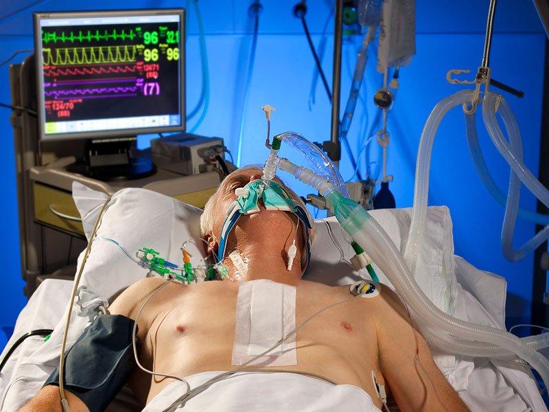 dbpdata's tweet image. They are talking about the ventilator shortage. These things are horrible. My mother called it torture before she died from it. It's a desperate last resort measure. I don't blame them from trying it in my mother's case. They should be used less.