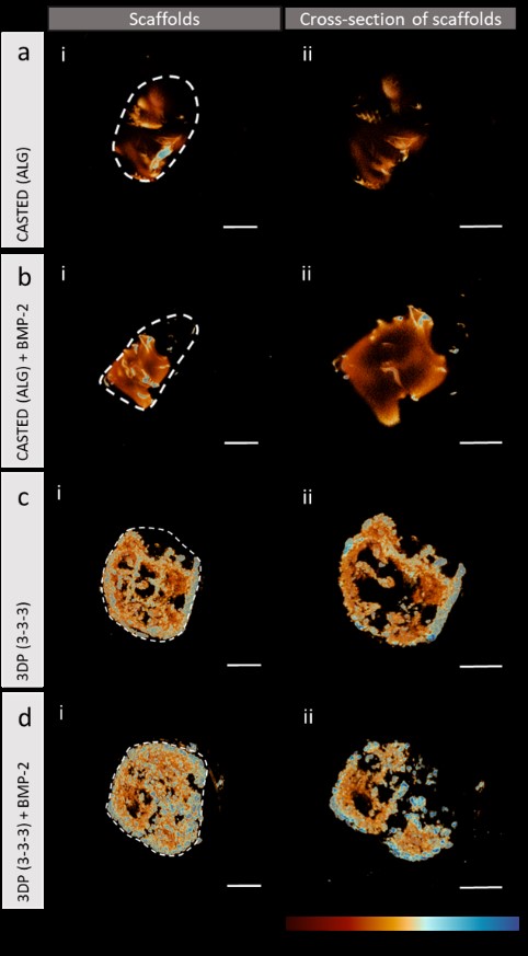 We wanted to investigate the regenerative potential of acellular 3D printed 3-3-3 compared to some alginate controls. We found that the 3-3-3 3D printed scaffolds could self-mineralise over a period of 4 weeks, even in the absence of loaded bone-stimulating factors.6/8