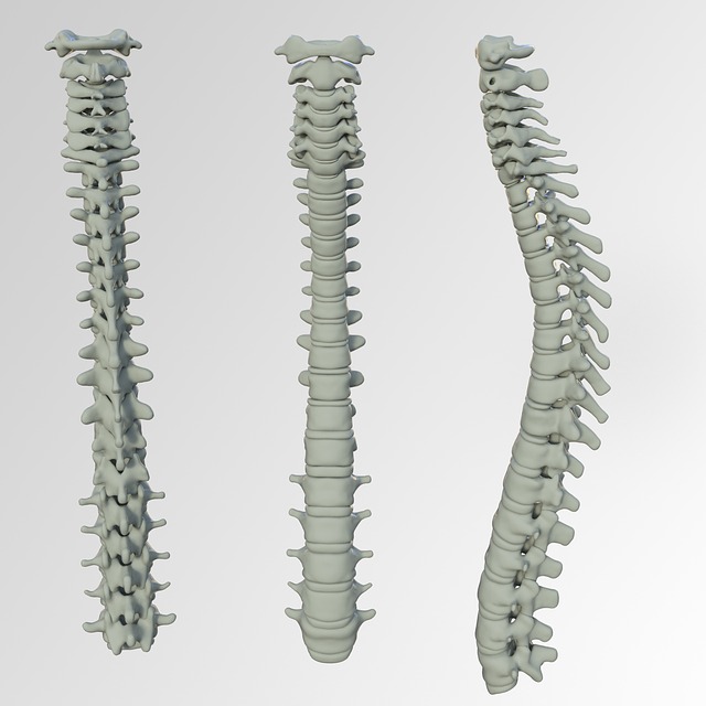 AfroMedic_'s tweet photo. Causes of Back Pain and Treatment Options - https://t.co/OZ5LNrVPOa via @Verywell  #backpain https://t.co/Rfwl90RUPH