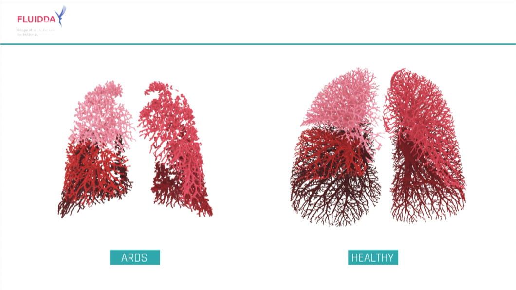 atvbe's tweet photo. Antwerps technologiebedrijf ontwikkelt 3D longscans #atvbe #longscan #coronavirus #covid19 #fluidda #Kontich
https://t.co/wUFJaYSIoJ https://t.co/5WmRGvIvjX
